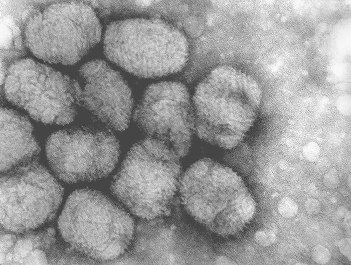 Smallpox_virus.jpg