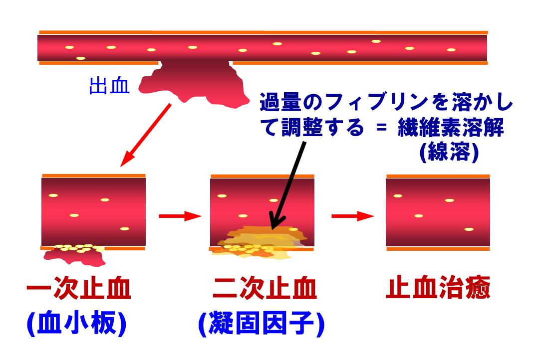 fibirinolysis.jpg