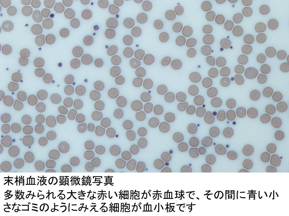 platelets.jpg